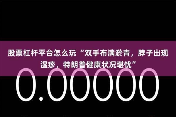 股票杠杆平台怎么玩 “双手布满淤青，脖子出现湿疹，特朗普健康状况堪忧”